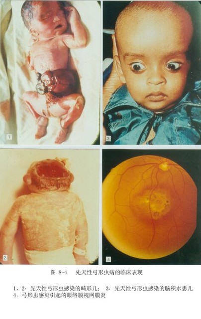 宠物真的比宝宝重要吗?