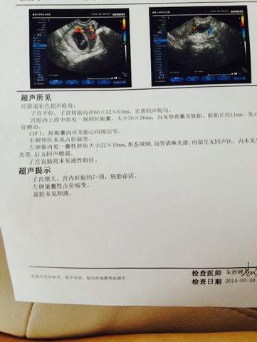 journal_insert_pic_147075431
