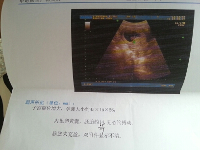 journal_insert_pic_147418725