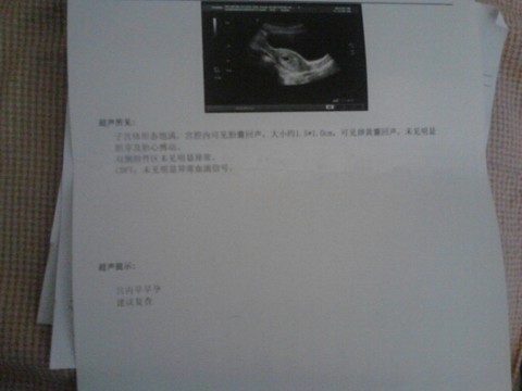 journal_insert_pic_147520643