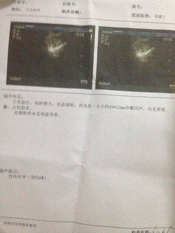 journal_insert_pic_147884744