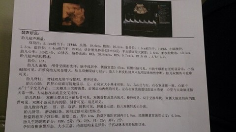 journal_insert_pic_147905571