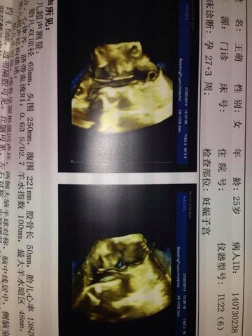 journal_insert_pic_148045135