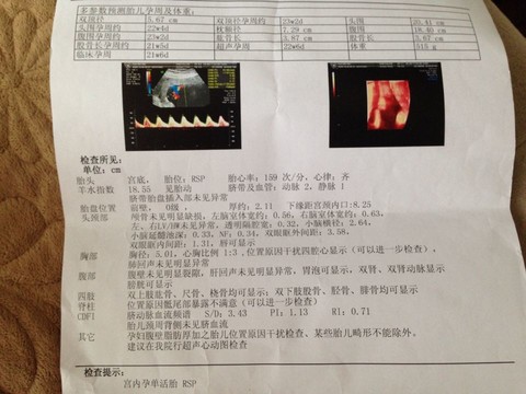journal_insert_pic_148048971