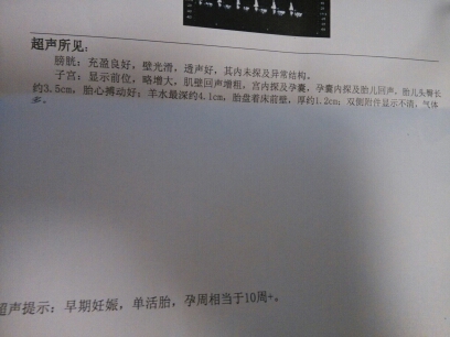 journal_insert_pic_149404788