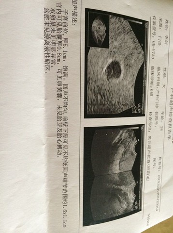 journal_insert_pic_149384557