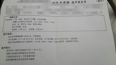 journal_insert_pic_149831810