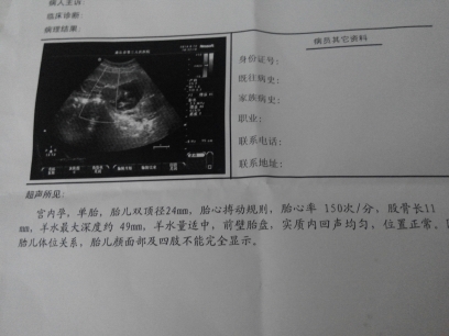 journal_insert_pic_150259272