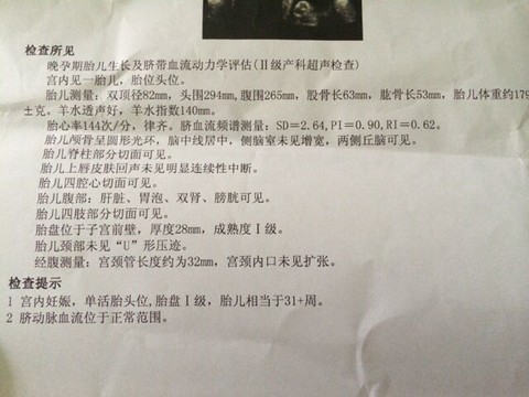 journal_insert_pic_150458183