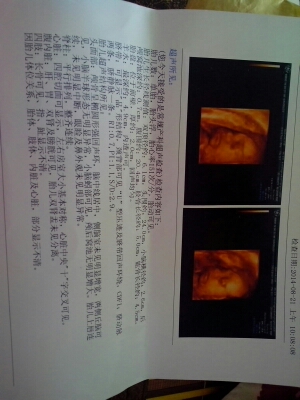 journal_insert_pic_150712100