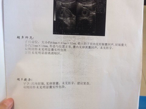 journal_insert_pic_150937140
