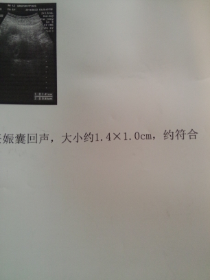 journal_insert_pic_150911948