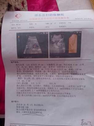 journal_insert_pic_151065402