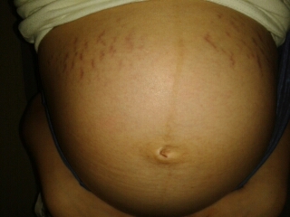 journal_insert_pic_151201589