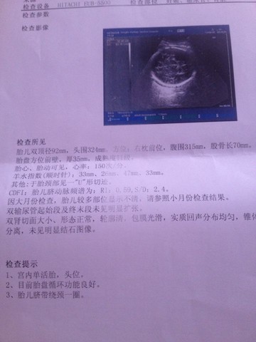 journal_insert_pic_151370064