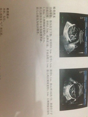 journal_insert_pic_151610357