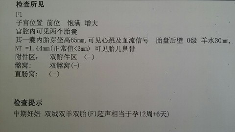 journal_insert_pic_151658924