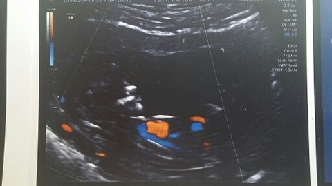 journal_insert_pic_151658932