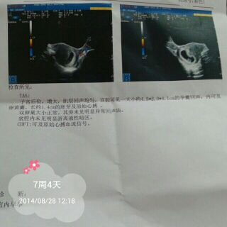 journal_insert_pic_151881903