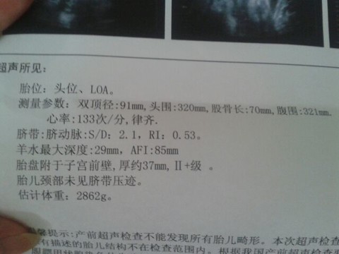 journal_insert_pic_151867831