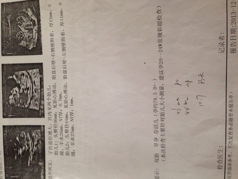 journal_insert_pic_151918986