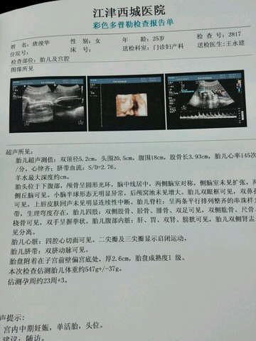 journal_insert_pic_153130145