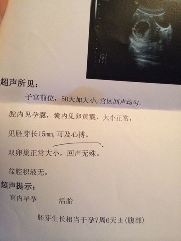 journal_insert_pic_153177835