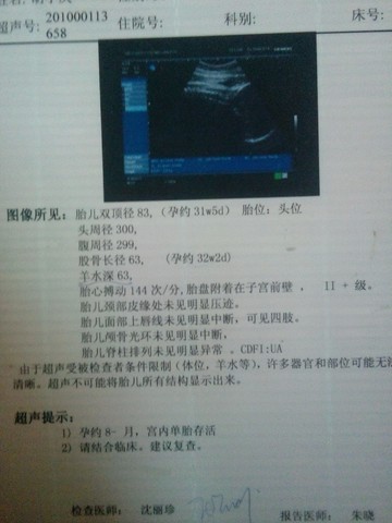 journal_insert_pic_153292058