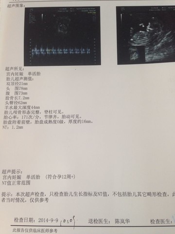 journal_insert_pic_153604499