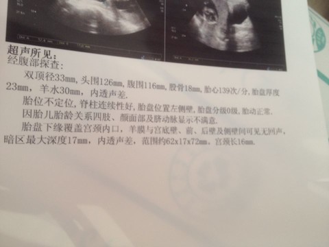 journal_insert_pic_153846219