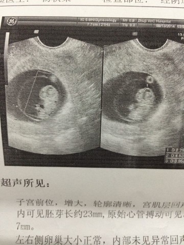 journal_insert_pic_154344268