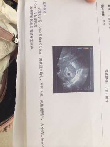 journal_insert_pic_154396593