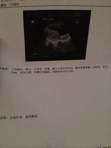 journal_insert_pic_155301258