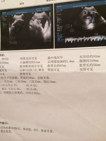 journal_insert_pic_156052253