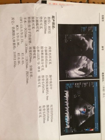 journal_insert_pic_156052244