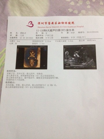 journal_insert_pic_157263065