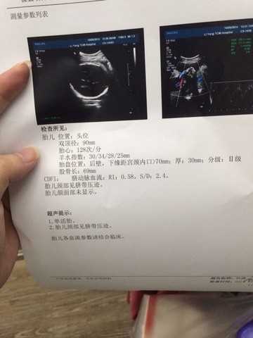 journal_insert_pic_157465995