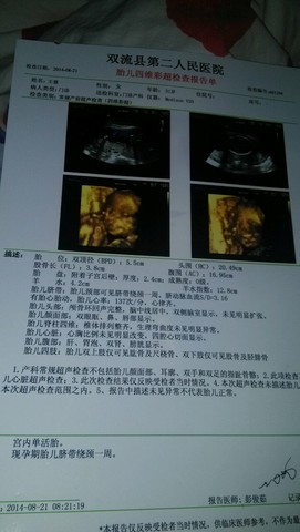 journal_insert_pic_158831008