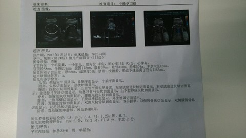 journal_insert_pic_159486931