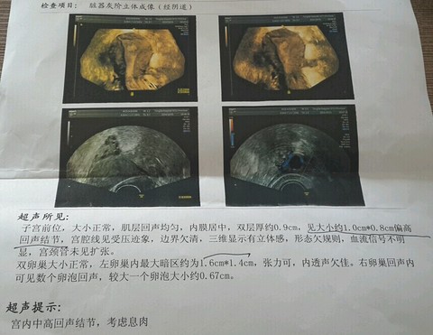 journal_insert_pic_160561447