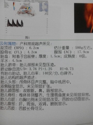 journal_insert_pic_162751094