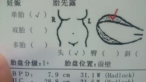 journal_insert_pic_167439870