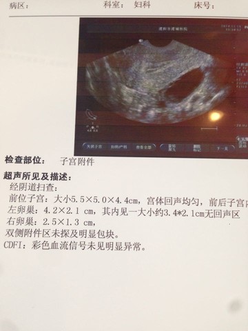 journal_insert_pic_168055869