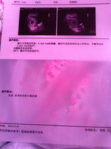journal_insert_pic_168545985
