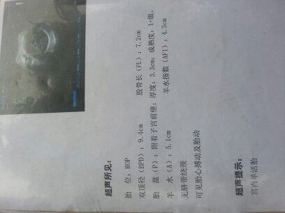 journal_insert_pic_169798520