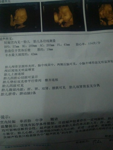 journal_insert_pic_171455419