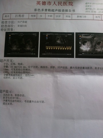 journal_insert_pic_171351338