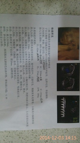 journal_insert_pic_172059756