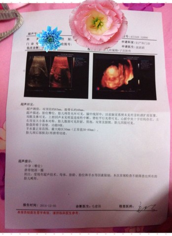 journal_insert_pic_172877212