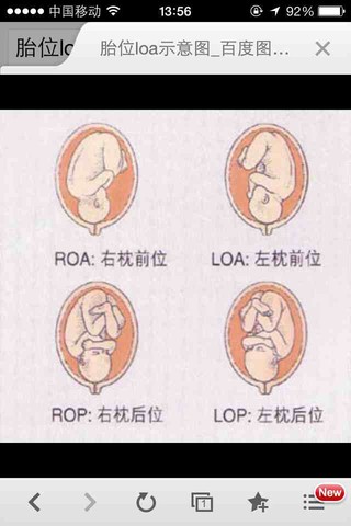 36周b超右枕后位什么意思啊_双顶径88mm,羊水57mm_宝宝树